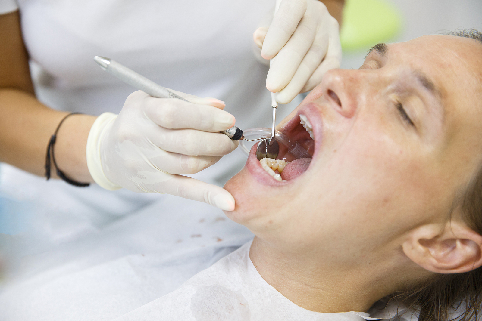 Top Tips for a Speedy Recovery After Tooth Extraction